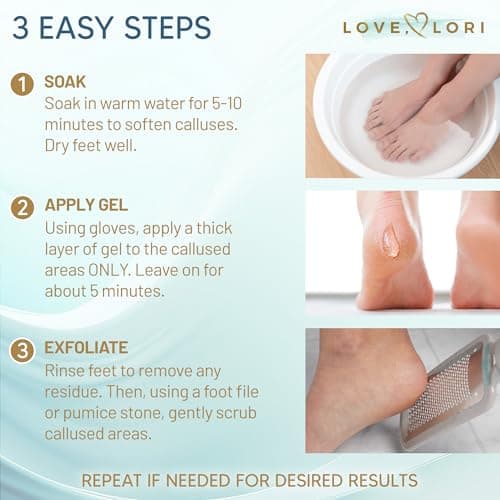 Callus Remover for Feet (Extra Strength) Foot Callus Remover Gel - Feet Scrubber, Pedicure Spa Tools, 6oz - Image 4