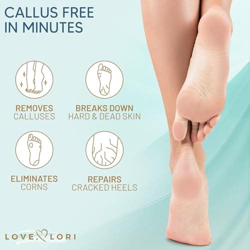Callus Remover for Feet (Extra Strength) Foot Callus Remover Gel - Feet Scrubber, Pedicure Spa Tools, 6oz - Image 5