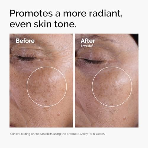 The Ordinary Glycolic Acid 7% Exfoliating Toner, Brightening and Smoothing Daily Toner for More Even-Looking Skin Tone, 3.4 Fl Oz - Image 2