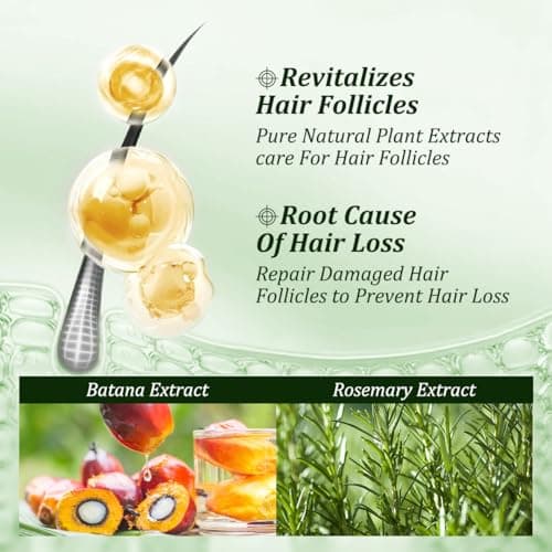 Gypsophila Batana Oil Shampoo for hair growth, Rosemary Shampoo,Nourishing & Rejuvenating for Softness & Volume, Suitable for Men & Women, Reduces Hair Loss (10.14 fl oz) - Image 4