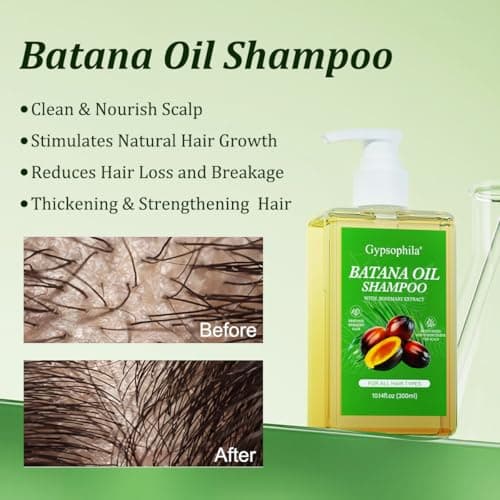 Gypsophila Batana Oil Shampoo for hair growth, Rosemary Shampoo,Nourishing & Rejuvenating for Softness & Volume, Suitable for Men & Women, Reduces Hair Loss (10.14 fl oz) - Image 3