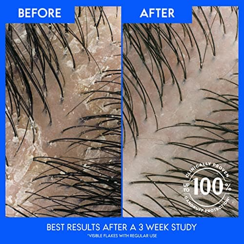 Head & Shoulders Itchy Scalp Care Dandruff Shampoo, Anti-Dandruff Treatment, Infused with Eucalyptus, 32.1 Fl Oz Each, Twin Pack - Image 3