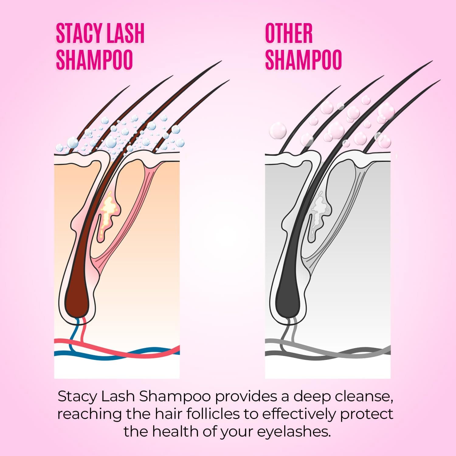 STACY LASH Lash Shampoo Kit Foaming Cleanser with Eye Lash Spoolies & Rinse Bottle & Cleansing Pad & Brush for Eyelash Extensions & Clusters & Natural Eyelashes 1.69 fl oz (50 ml) Lash Shampoo Kit - Image 8