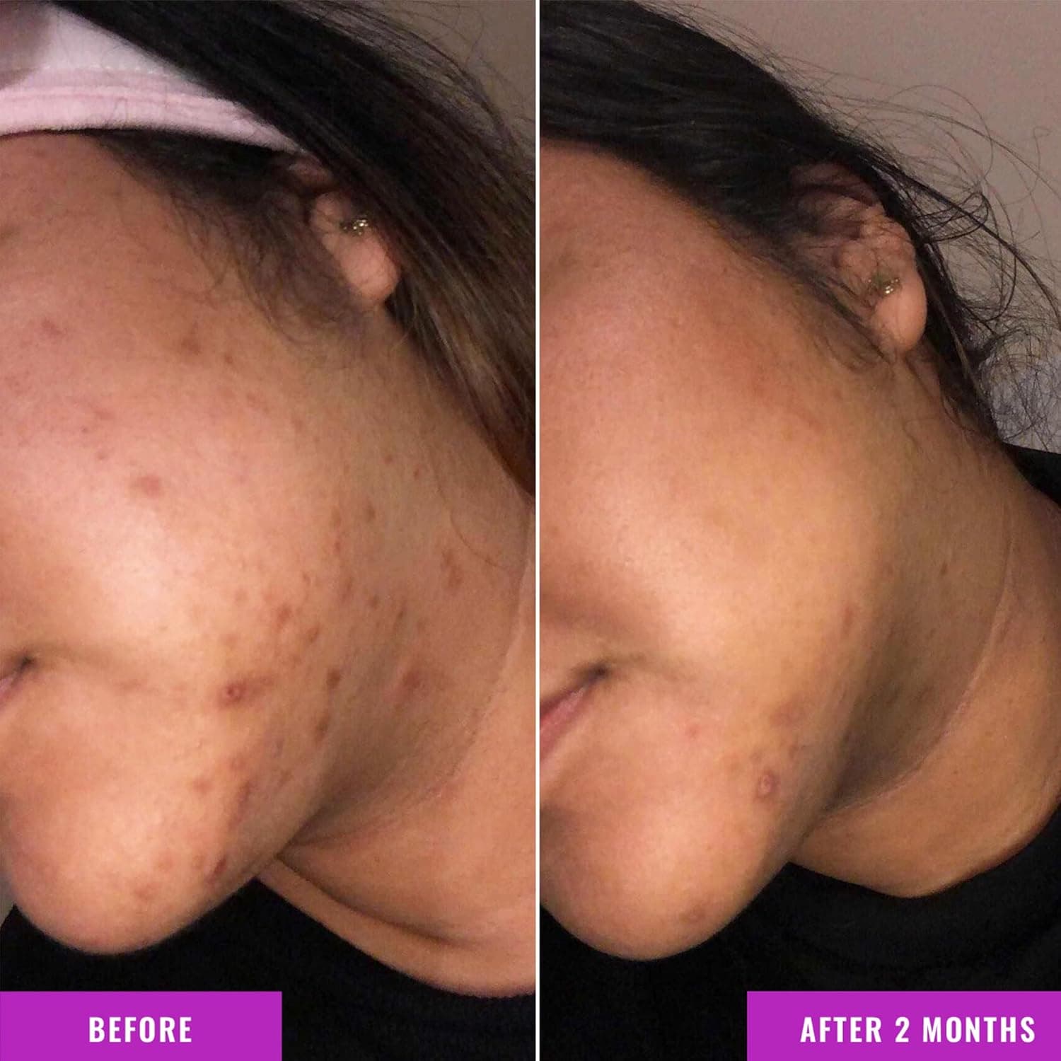 Good Molecules Discoloration Correcting Serum - Tranexamic Acid and Niacinamide Serum to Target Dark Spots and Hyperpigmentation - Skin Care for Face 1 Fl Oz (Pack of 1) - Image 5