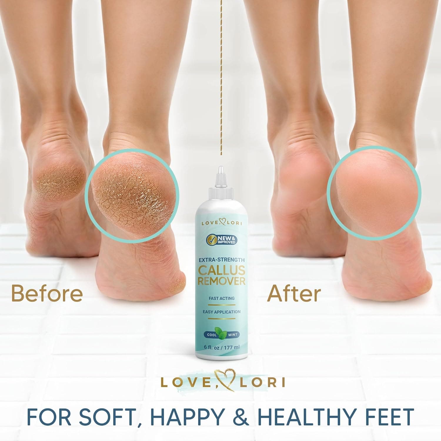 Callus Remover for Feet (Extra Strength) Foot Callus Remover Gel - Feet Scrubber, Pedicure Spa Tools, 6oz - Image 4