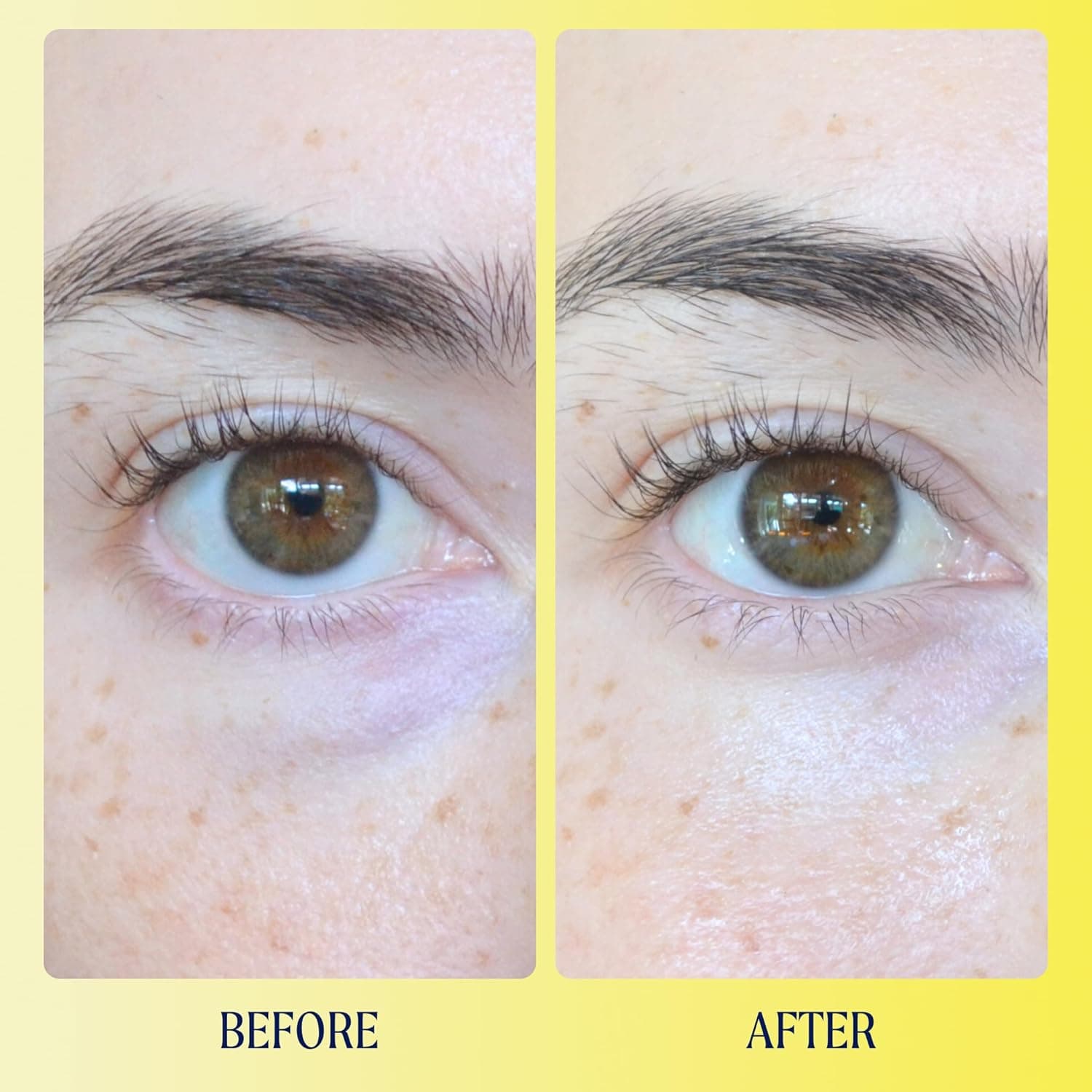 Kinship Brightwave Vitamin C Under Eye Brightener Cream for Sensitive Skin | Dark Circles Under Eye Treatment | Diminishes Fine Lines | Hydrating Eye Cream w/Antioxidants | Fragrance Free, (0.5 Oz) 0.5 Ounce (Pack of 1) - Image 5