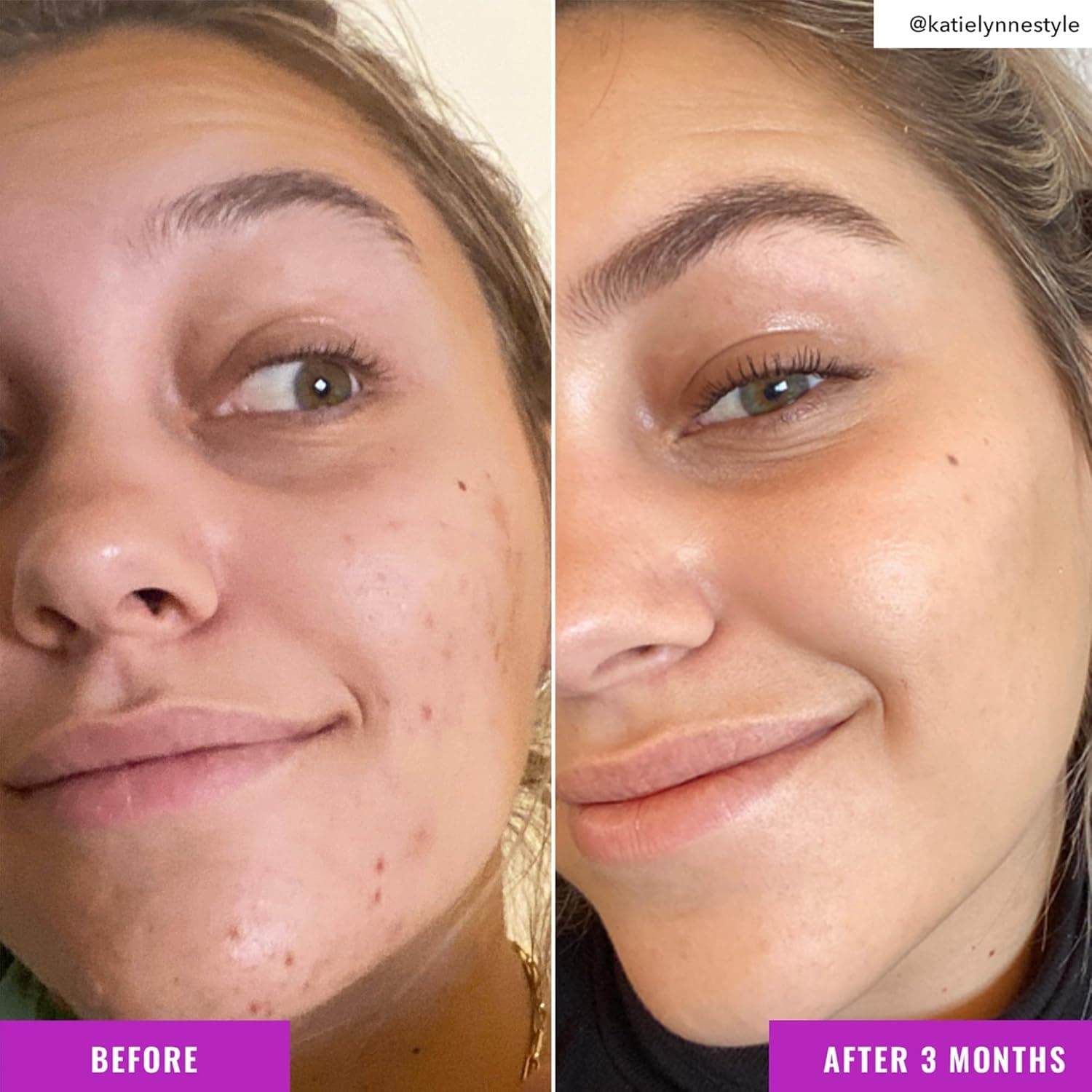 Good Molecules Niacinamide Brightening Toner - Toner for Face with Niacinamide and Arbutin for Skin Tone Balancing- Pore Minimizer, Skin Care for Face 1 Fl Oz (Pack of 1) - Image 6