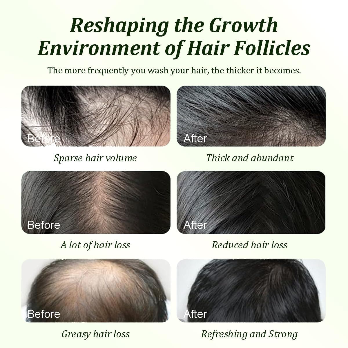 Batana Oil Shampoo,Rosemary Shampoo,Nourishing & Rejuvenating for Softness & Volume, Suitable for Men & Women, Reduces Hair Loss (10.14 fl oz) 10.14 Fl Oz (Pack of 1) - Image 6