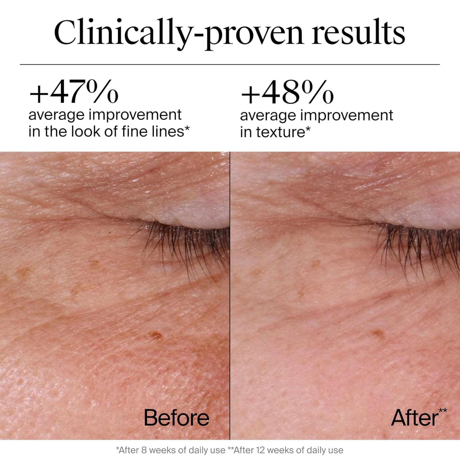 Neutrogena Rapid Wrinkle Repair Retinol Face Moisturizer, Daily Anti-Aging Face Cream with Retinol & Hyaluronic Acid to Fight Fine Lines, Wrinkles, & Dark Spots, 1.7 oz 1.7 Ounce (Pack of 1) - Image 4