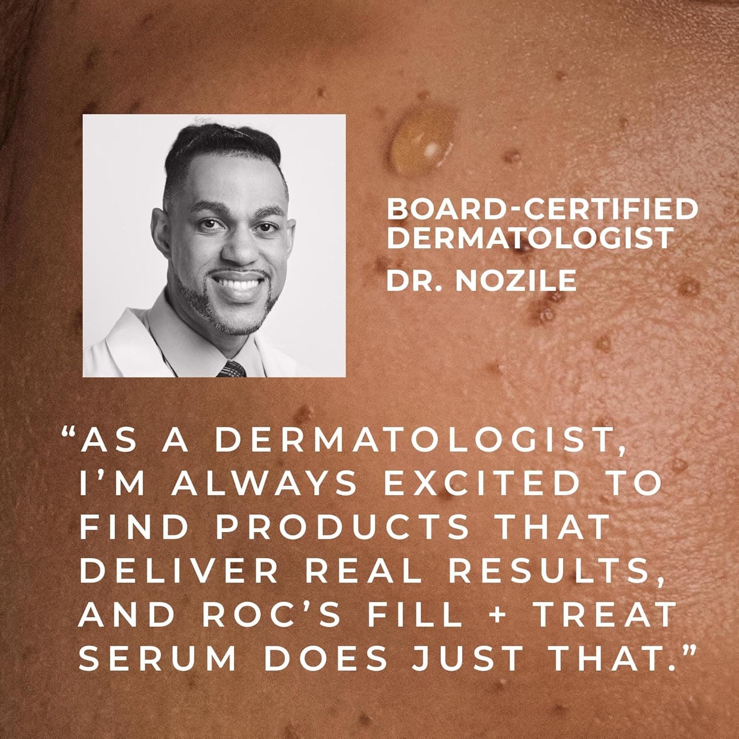 RoC Derm Correxion Fill + Treat Advanced Retinol Serum, Wrinkle Filler Treatment with Hyaluronic Acid for Crow's Feet, 11 Wrinkles, & Laugh Lines, (.5 fl oz) with Retinol Packette (Packaging May Vary) - Image 11